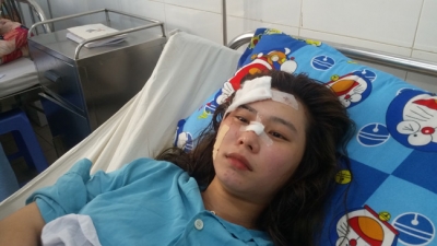 Nạn nhân kể lại phút kinh hoàng khi xe khách bị lật ở đèo Hải Vân