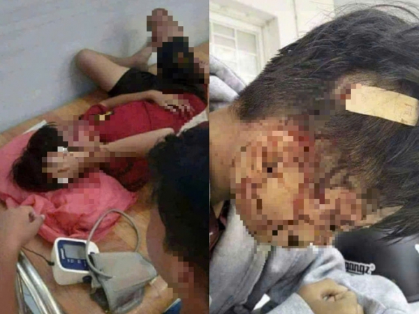 Nam sinh ở An Giang cầm hung kh&iacute; quật li&ecirc;n tiếp v&agrave;o đầu bạn