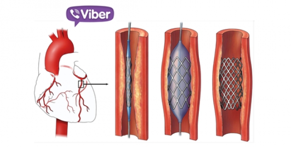 Kết nối Viber, cứu người đàn bà bị nhồi máu cơ tim trên xe