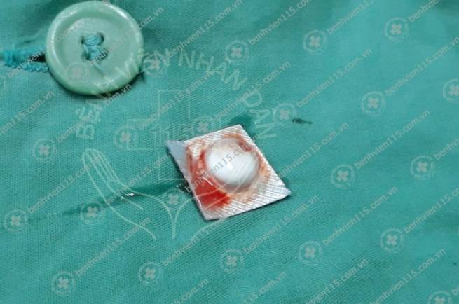 Uống cả vỏ thuốc, người đ&agrave;n &ocirc;ng li&ecirc;n tục ho ra m&aacute;u