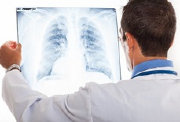 Hơn 6 triệu người mắc bệnh hen và COPD