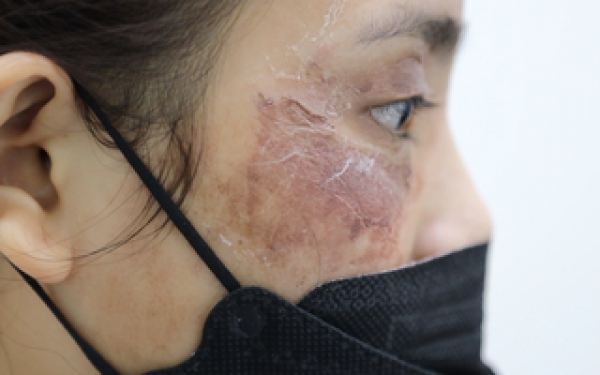 Mỹ phẩm giả t&agrave;n ph&aacute; dung nhan, sức khỏe